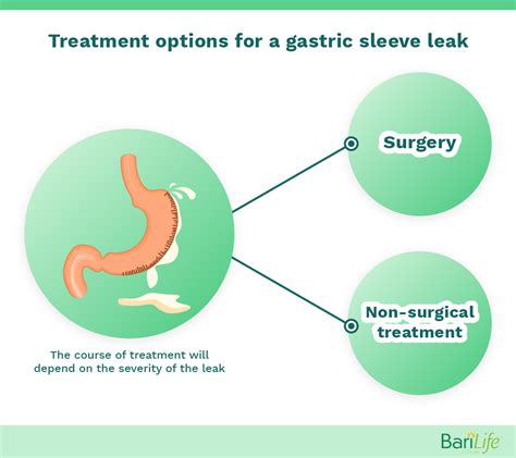 gastric sleeve leak|Gastric Sleeve Leak: Signs & Symptoms of Staple Line Leak